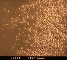 Abbildung 2: mikroskopische Betrachtung der Glaskorrosion Quelle: Glastechnische Tagung Leipzig 2003 In Abbildung 2 ist rechts im Bild der