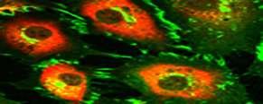 Primäre Zellsysteme Endotheliale Zellen Fibroblasten Glattmuskelzellen