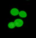 3. Ergebnisse 63 10µm 10µm 10µm A B C Abb. 18: Mikroskopische Betrachtung der Stämme KFY3/pCl1 und KFY6/pKF9/pCl1. In Bild A ist die GFP-Fluoreszenz in Stamm KFY3/pCl1 dargestellt.