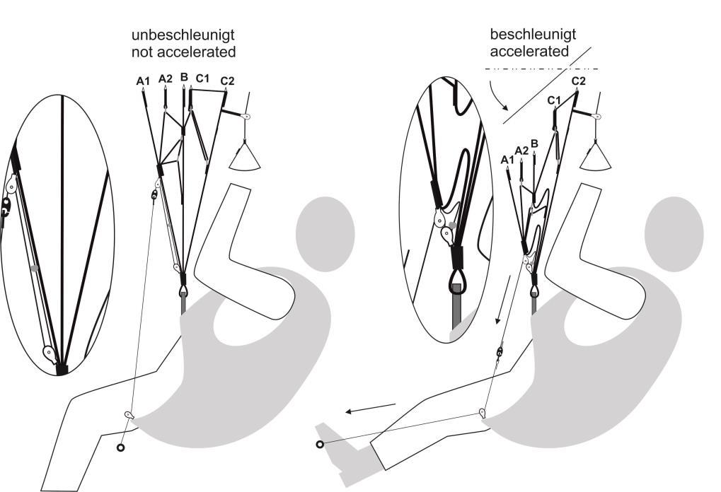 Die Verbindung zwischen Fußbeschleuniger und Tragegurt wird über spezielle Brummelhaken hergestellt.