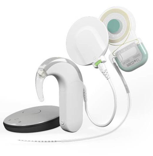 4 Indikationen für implantierbare Hörsysteme Indikationen für implantierbare Hörsysteme 5 Cochlea-Implantat (SYNCHRNY der Firma MED EL) Das SYNCHRNY kann das Hören durch direkte Stimulation der