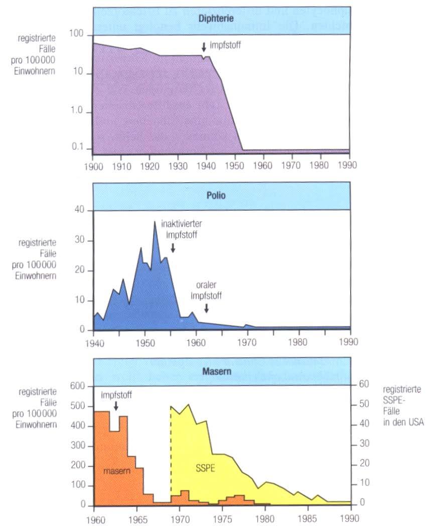 Reduktion von Infektionskrankheiten NACH Einführung der Impfungen SSPE =Subakute sklerosierende