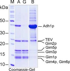Ergebnisse Im weiteren Verlauf der Reinigung wurde mittels TEV-Protease der Hexahistidin-Rest von der Gim6p-Untereinheit abgespalten (s. 2.4.4.3.3.). In Abb. 3.