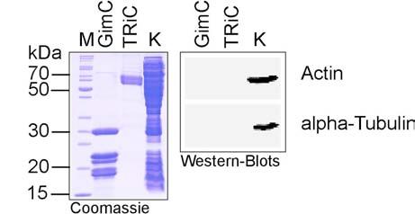 Ergebnisse Abb. 3.30: Western-Blot Analyse bestätigt die Integrität von gereinigtem GimC. Aliquots von (1) je 10 µg Protein des Total-Extraktes und (2) je 0.