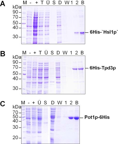 Ergebnisse pondierenden WD-repeat Proteinen benötigt (s. 2.4.11.2.2.). Aus einer 20 ml Kultur wurden ca. 415 µg Pot1p-6His, 30