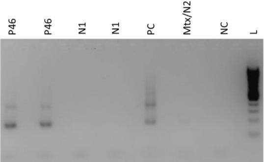 4.2.2 PCR-2 TczF-TczR Intraassay Tag 1 Interassay I Interassay II Tag 2 Tag 3 Abbildung 6. Intra- und Interassay.