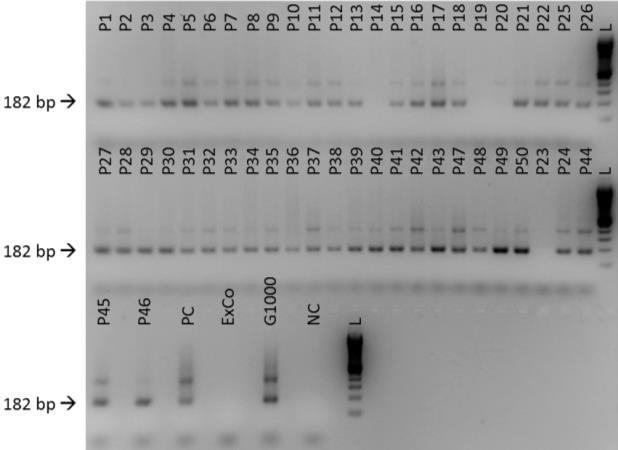 4.3.1.2 PCR-1 121-122 Abbildung 9. Sensitivität. Es wurden 55 bekannt positive Proben (P1-P55) untersucht.