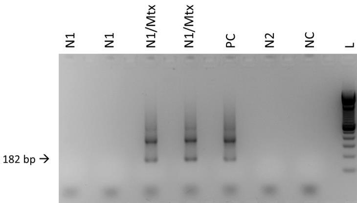 4.5 Matrixeffekt 4.5.1.1 PCR-1 121-122 Abbildung 25. Matrixeffekt. Bei der Analyse des Matrixeffektes wurden eine bekannt negative Probe eines gesunden Individuums (N1) und dieselbe Probe, versetzt mit Kulturmaterial des T.