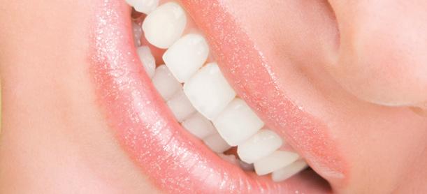 Reflex dimension Bleach Immer mehr Patienten wünschen sich perfekte, helle und weiße Zähne.