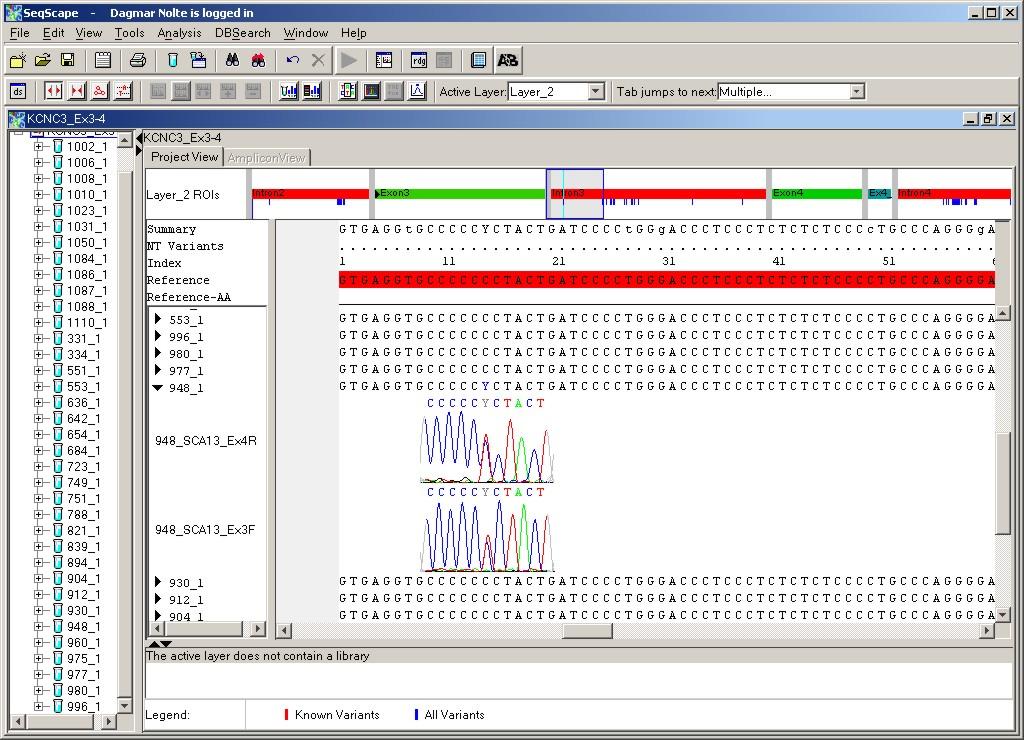4. Ergebnisse Die Variante im Intron 3 (intervening sequence, IVS3) an der Position +14 wurde bei 3 Patienten heterozygot nachgewiesen. Es fand ein Austausch von Cytosin zu Thymin statt.
