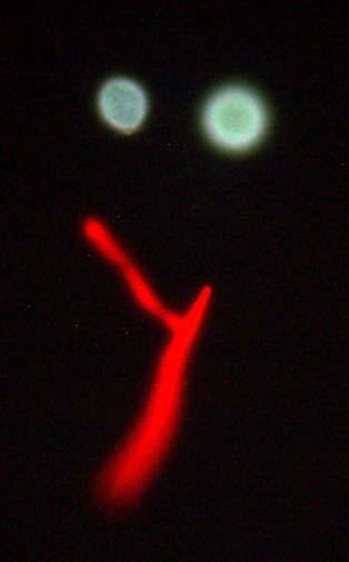 18 Keimschlauch markiert mit Alexa 568 (rot fluoreszierend) (1:200); Sporen mit blauer Eigenfluoreszenz Weiterführende Arbeiten zur Immunfluoreszenzmarkierung in vivo an Sorten unterschiedlicher