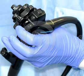 Die starren Endoskope zeichnen sich durch folgende Eigenschaften aus: Die flexiblen Endoskope für den HNO-Bereich zeichnen sich durch folgende