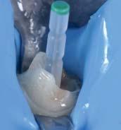 Gewährleistung der Haltbarkeit des Zahns im Kieferknochen in biologischer und struktureller Hinsicht.
