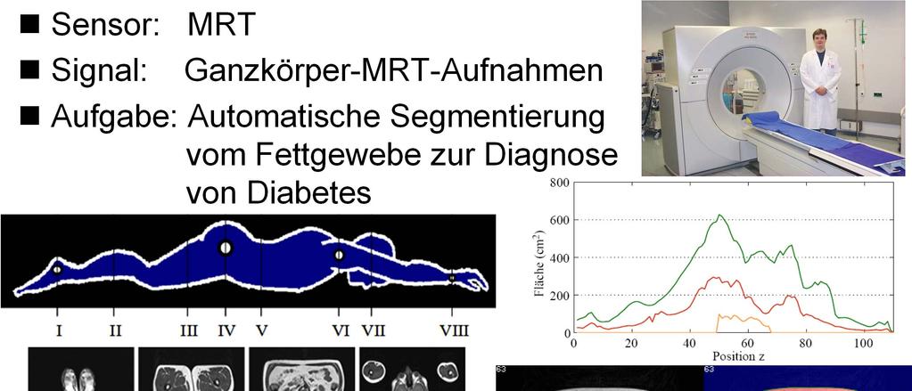 Beispiele medizinischer Signalverarbeitung