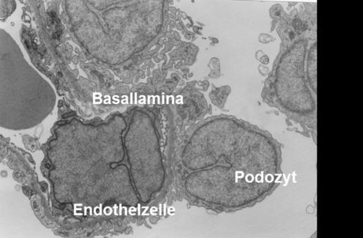 Signifikant ab 9,2 µg/l Schwarz et al.