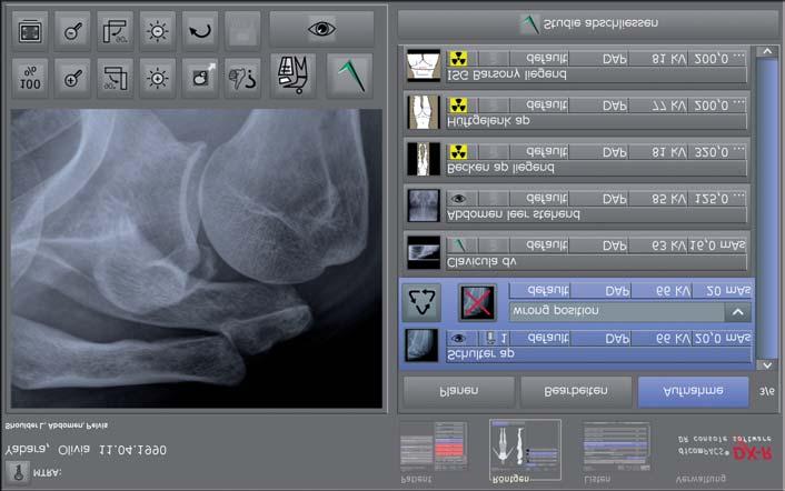 Zeigt ein korrektes Röntgenbild der Untersuchung dicompacs DX-R Röntgenhelfer Öffnet fehlerhafte