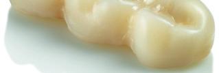 Hohe Ästhetik ü Zahnähnliche Transluzenz und Opaleszenz