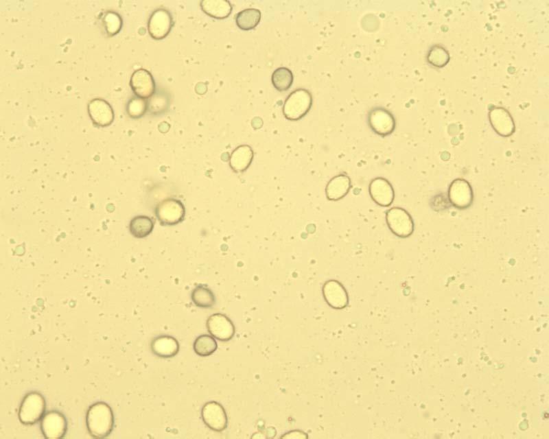 phalloides Grüner Knollenblätterpilz Marginalzellen