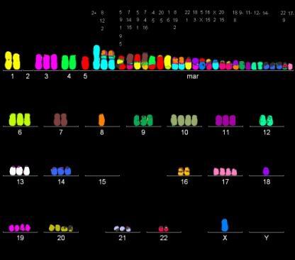 Chromosomen im Zellkern (chromosomale