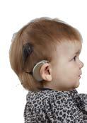 Die bimodale Anpassung ist wichtig, weil das Kind von einer möglichst frühzeitigen Stimulation durch sowohl akustische als auch elektrische Klangquellen in seiner