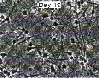 Drug Design) Neuronal differenzierte humane Stammzellen: humane ips Zellen ( human induced