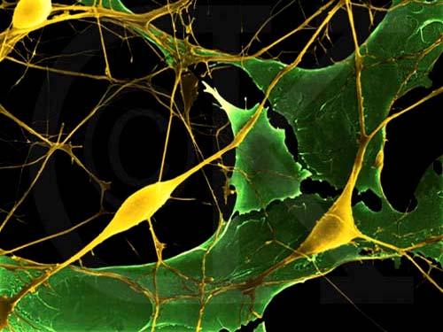 < phi-t >NeuroBayes Neuronale Netzwerke: