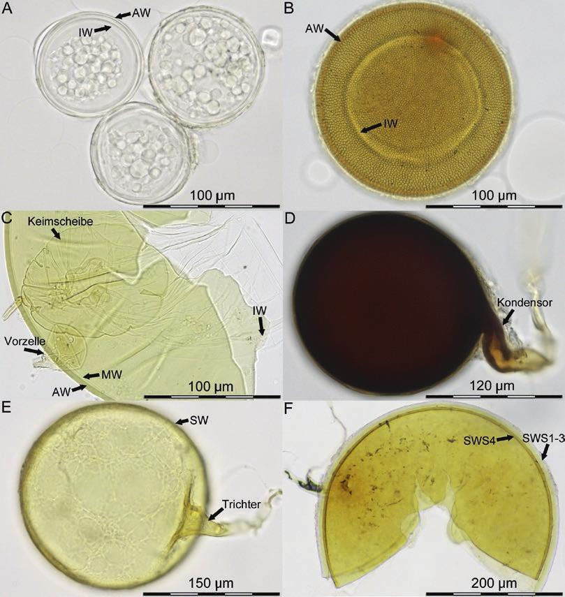 Umwelt Diversität arbuskulärer Mykorrhizapilze in Ackerkulturen bei Direktsaat und Pflug Abb. 3 AM-Pilzsporen ausgewählter Arten.
