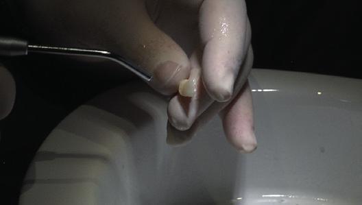 Knochenersatzmaterialien werden seit langer Zeit erfolgreich in der Zahnmedizin eingesetzt.