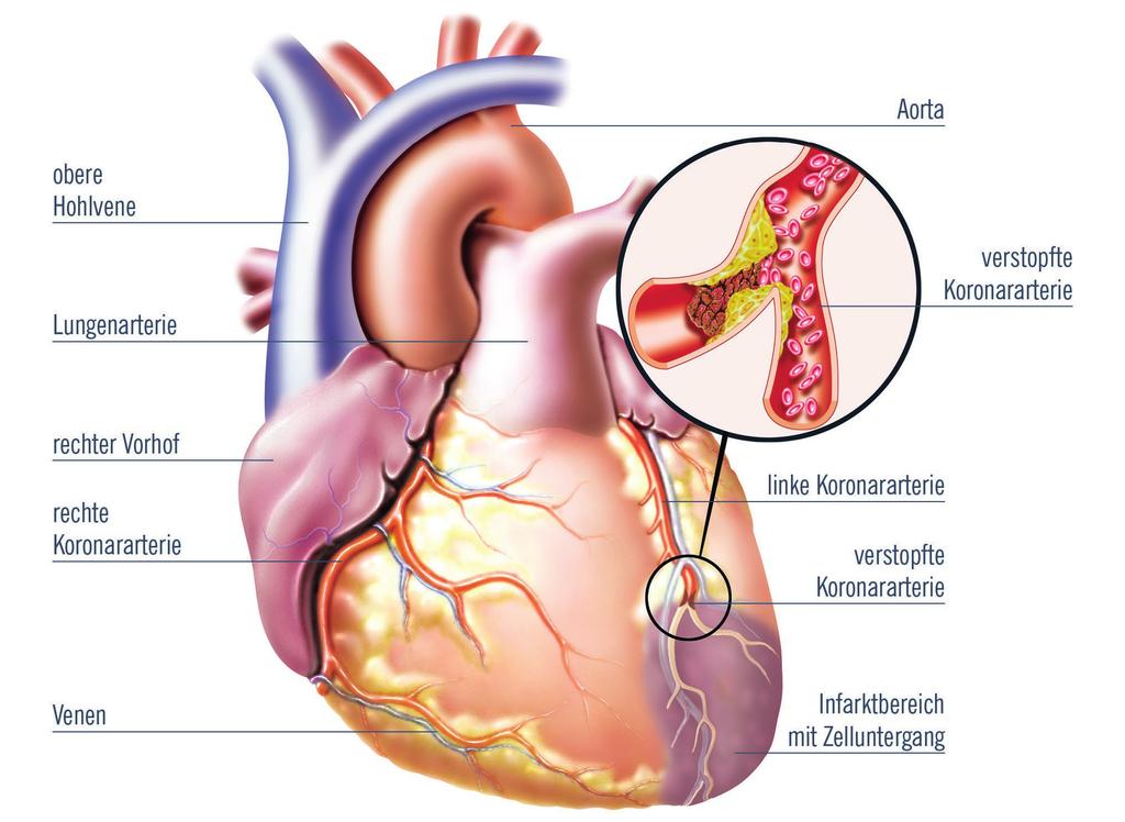 Was & Wo sind die Herzkranzgefäße? Das Herz schlägt rund 100.000 Mal täglich.