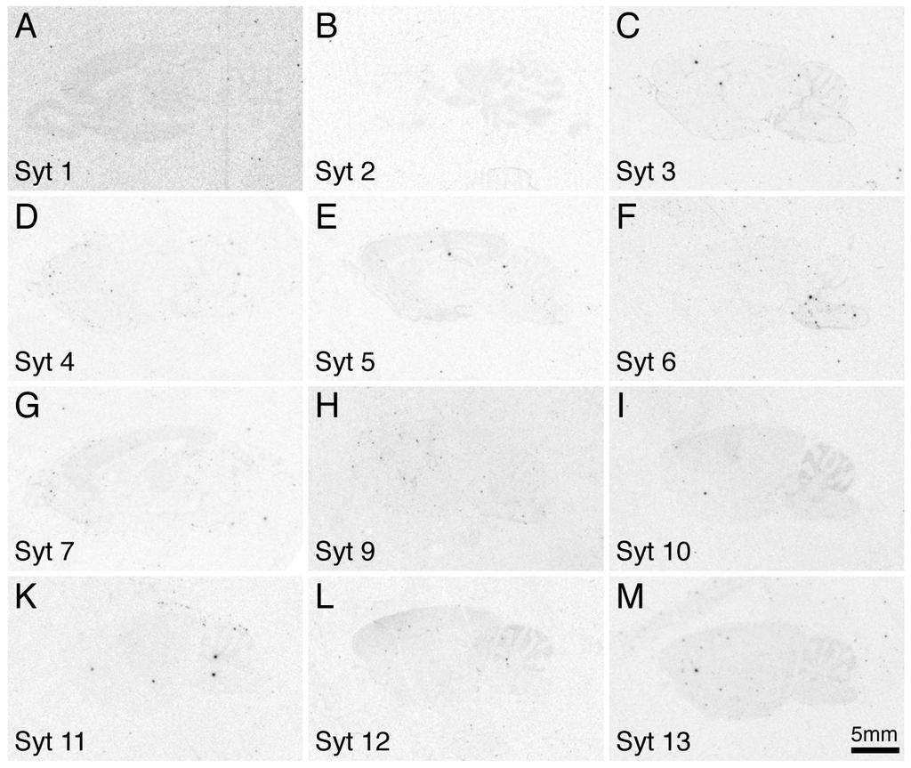 4 Results 64 Figure 4.16: X-ray film images showing the background controls of the different Synaptotagmin probes performed with 1000-fold excess of the respective unlabeled oligonucleotide. 4.2.