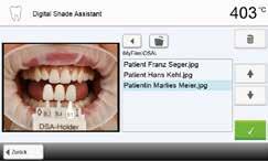 5. Bedienung und Konfiguration 5.6 Digital Shade Assistant (DSA)-Funktion Der Programat CS3 verfügt über eine Funktion zur Bestimmung der Zahnfarbe auf Basis von drei ausgewählten Referenzzähnen.