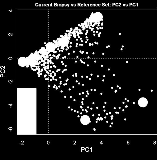 21-3.8 5.8 0.03 Moderate Acute Kidney Injury (AKI) Score 4 0.28-0.6 1.6 0.42 Mild Atrophy-Fibrosis Score 5 0.78 0.0 1.