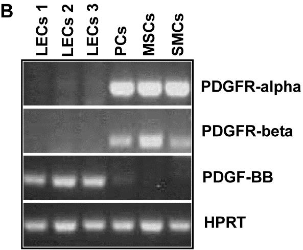 Ergebnisse Weder PDGFβR noch PDGFαR werden auf der RNA- oder der Proteinebene von LECs exprimiert (Abbildung 10A und 10B).