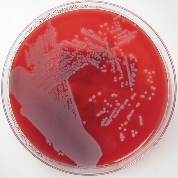 Kultur von Bakterien (gram