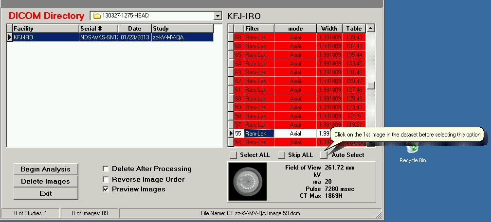 Dann auf Auto Select klicken: Da die Software den Modulaufbau kennt, weiß sie