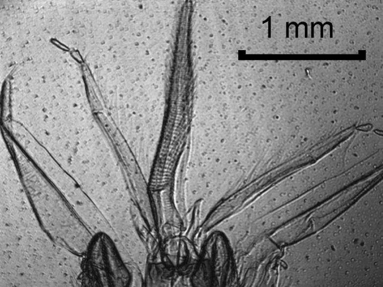 Zoom Mikroskopie MDOE 1 MDOE 2 CCD ff > 0 ff < 0 Mouth parts of a honey bee