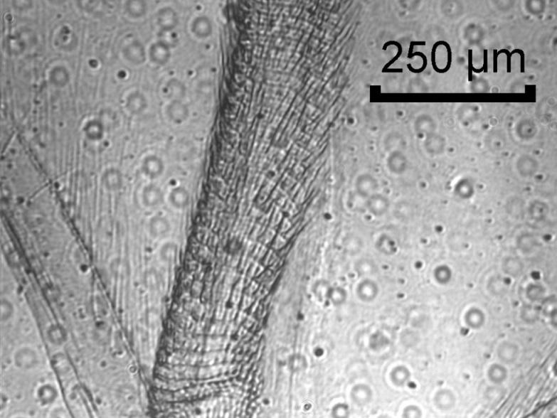 Zoom Mikroskopie MDOE 1 MDOE 2 CCD ff > 0 ff < 0 Mouth parts of a honey bee
