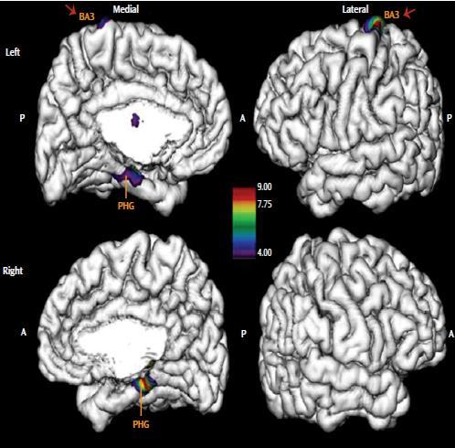 in der für Genitale und Klitoris zuständigen Region und im gyrus parahippocampalis Sherin &