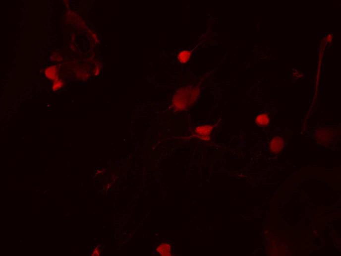 Ergebnisse Versuche zur Lyse der Zellkerne Der autokatalytische Zusammenbau der Kapside findet im Zellkern statt.