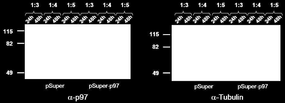 22: Transfektion von psuper-p97. NRK-49F Zellen wurden mit psuper oder psuper-p97 transfiziert.