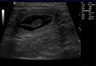 Ultraschallbild am 21. Tag der Trächtigkeit Eine embryonale Herzaktion wird erst ab dem 23. Tag nach der Befruchtung im Ultraschall sichtbar.