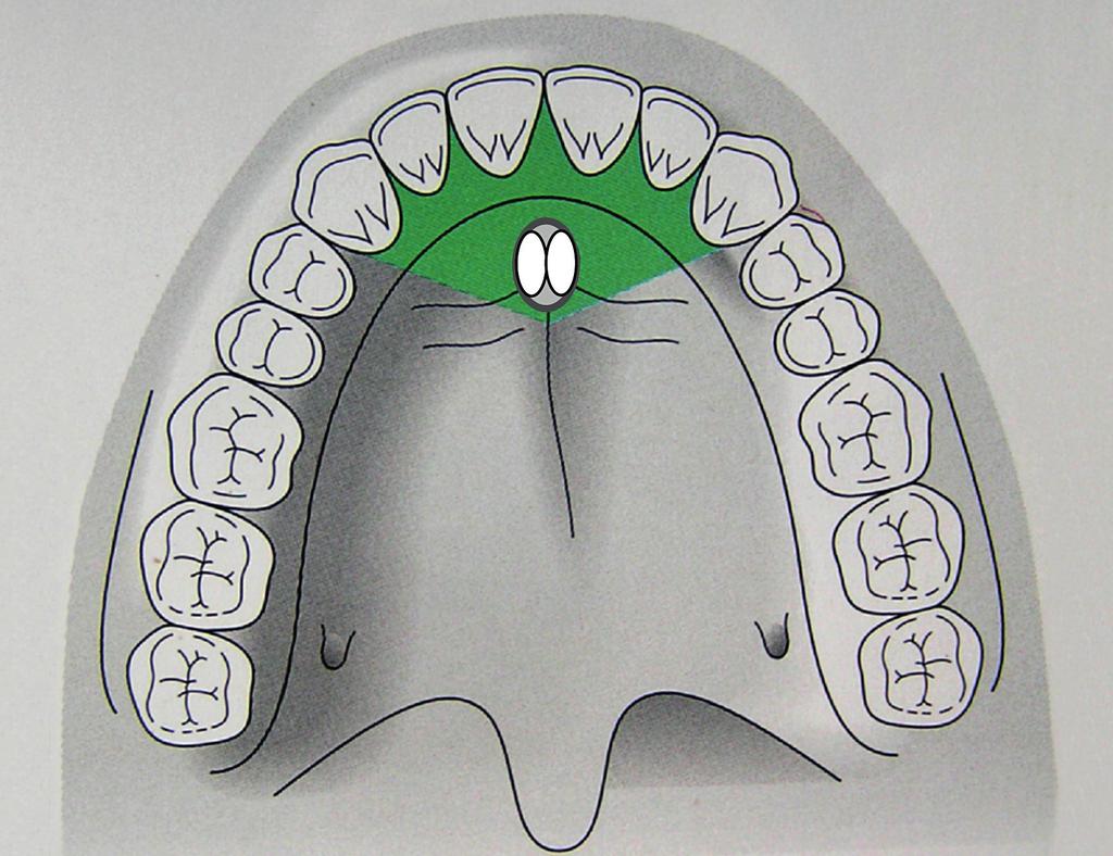 paarige Kanäle mit entsprechenden palatinalen und nasalen Öffnungen sowie Kanäle mit einer palatinalen und drei, vier und mehr nasalen Öffnungen ein.