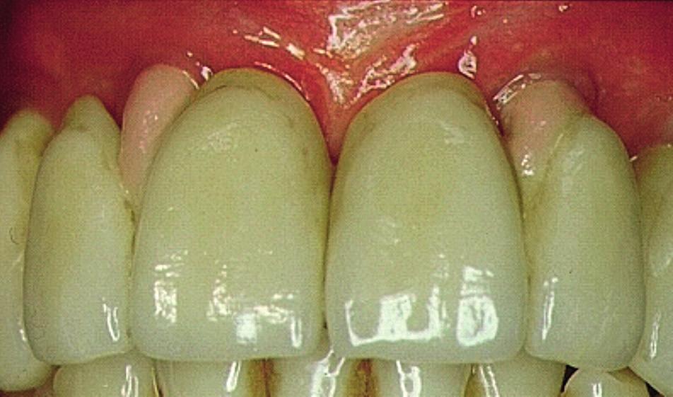 FACHBEITRAG FORSCHUNG & ENTWICKLUNG schiebung der Zähne in eine anteriore Position führen (Abb. 9).