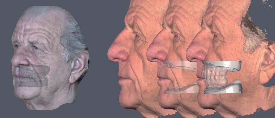 ANALYSE GESICHTSANALYSE Vorbereitung auf Fotoaufnahmen sowie die 3-D-Digitalisierung des Gesichts mit Gesichtsscanner Face Hunter.