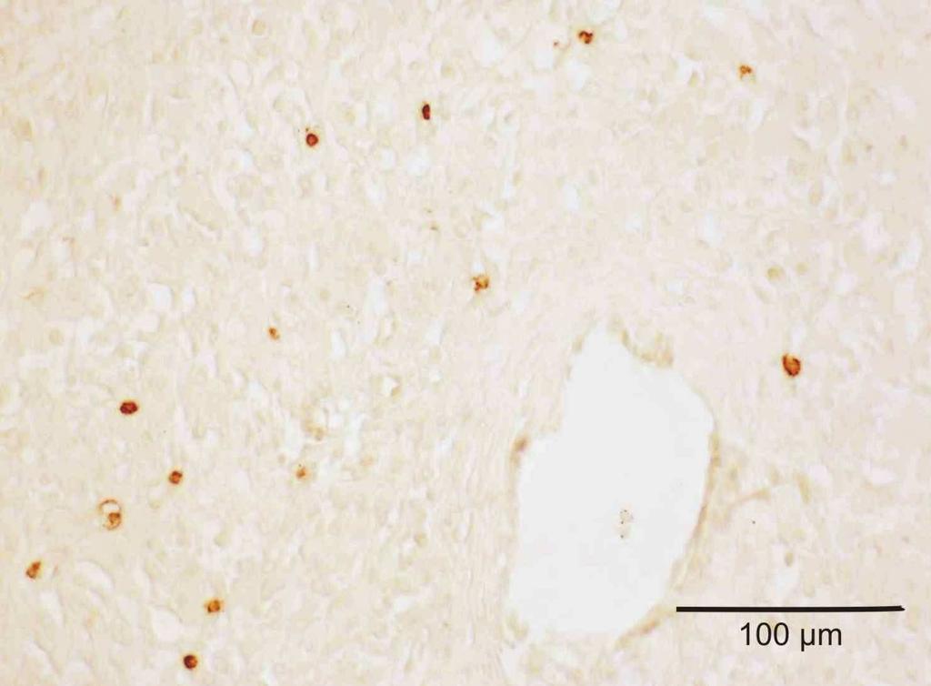Ergebnisse Abb. 12: Immunhistochemischer Nachweis CD45-positiver Zellen in bovinem Lutealgewebe (DAB-Färbung, 400x Vergrößerung). Leukozyten stellen sich als hell- bis dunkelbraun dar. Tab.