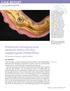 CASE REPORT. Prothetische Versorgung eines zahnlosen Kiefers mit einer. steggetragene Deckprothese, TOTALPROTHETIK