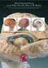 Drei Gehirnmodelle nach Prof. Dr. Dr. Med. J. W. Rohen. 15-teiliges zerlegbares Gehirnmodell und transparente Variante