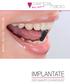 www.dental-ratio.de IMPLANTATE DER SMARTE ZAHNERSATZ