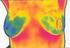 Mammacarcinom MammoVision - Thermographie der Brust Gesunde Ernährung bei Brustkrebs