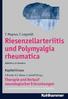 Riesenzellarteriitis und Polymyalgia rheumatica